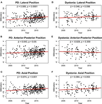 Evolution of Globus Pallidus Targeting for Parkinson's and Dystonia Deep Brain Stimulation: A 15-Year Experience